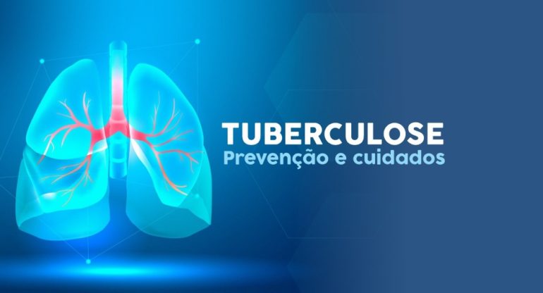 Estado parabeniza Colina pela realização da “Campanha da Tuberculose”