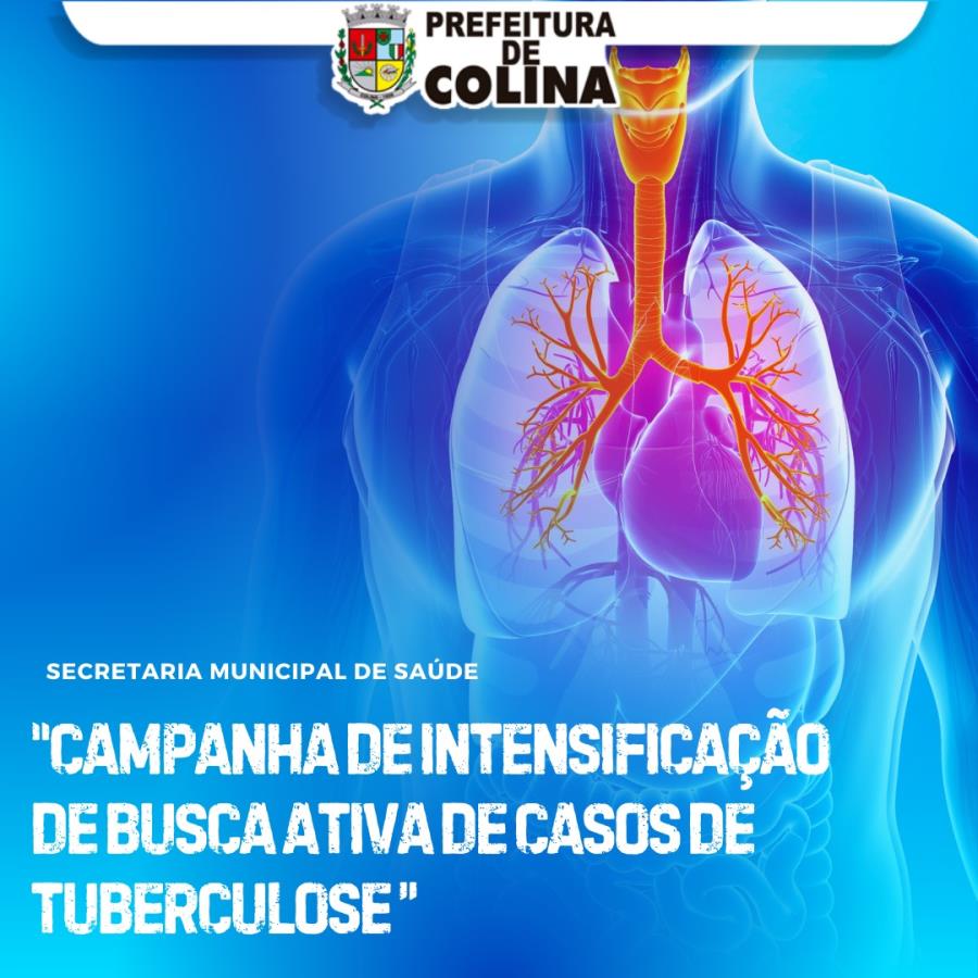 Saúde de Colina realiza busca ativa de casos de tuberculose