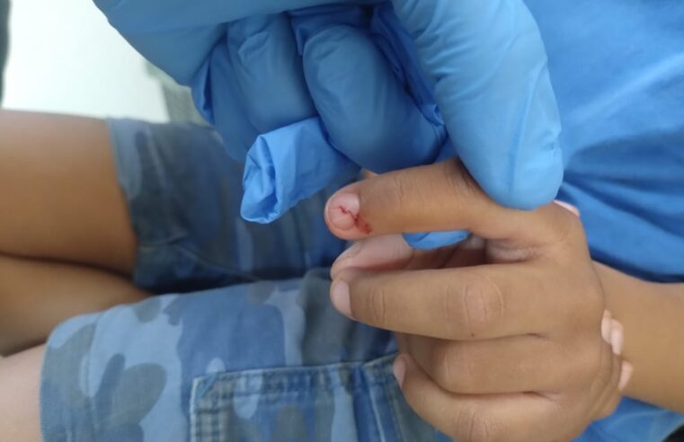 Bombeiros fazem retirada de apontador em dedo de criança