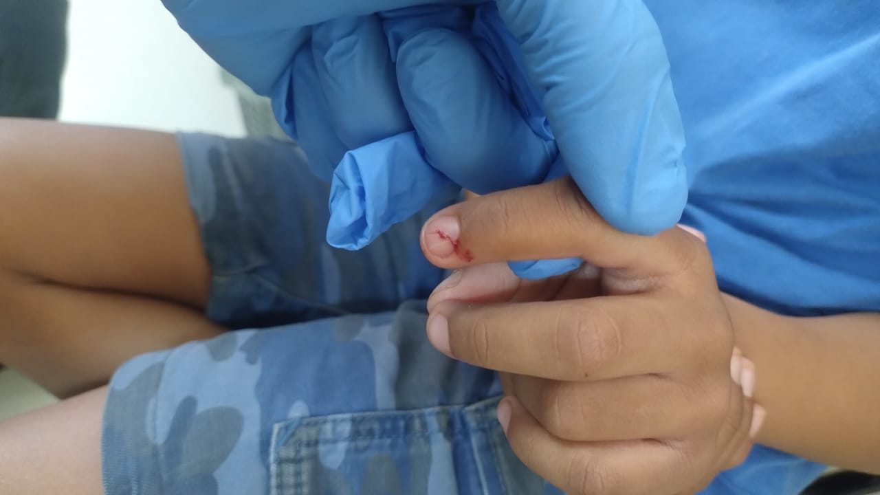 Bombeiros fazem retirada de apontador em dedo de criança