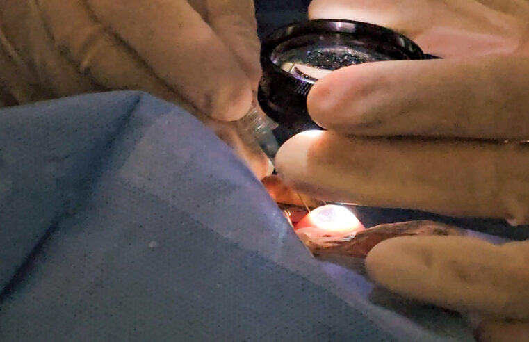 Hospital de Amor inaugura primeiro “Centro de Tratamento de Melanoma Uveal” do SUS, com braquiterapia ocular de alta tecnologia e análise molecular
